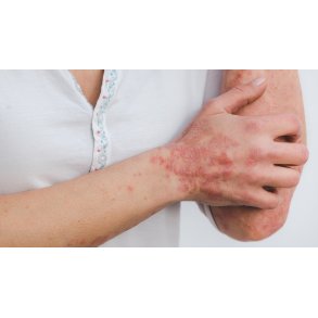 Dermatologi i praksis, Korsika 30.5-6.6.2026